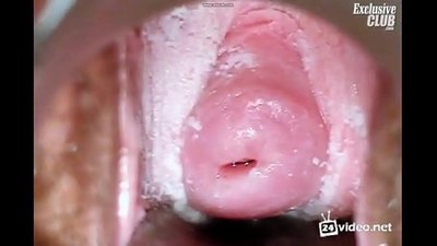 Gynecological na pagsusuri ng isang magandang babae
